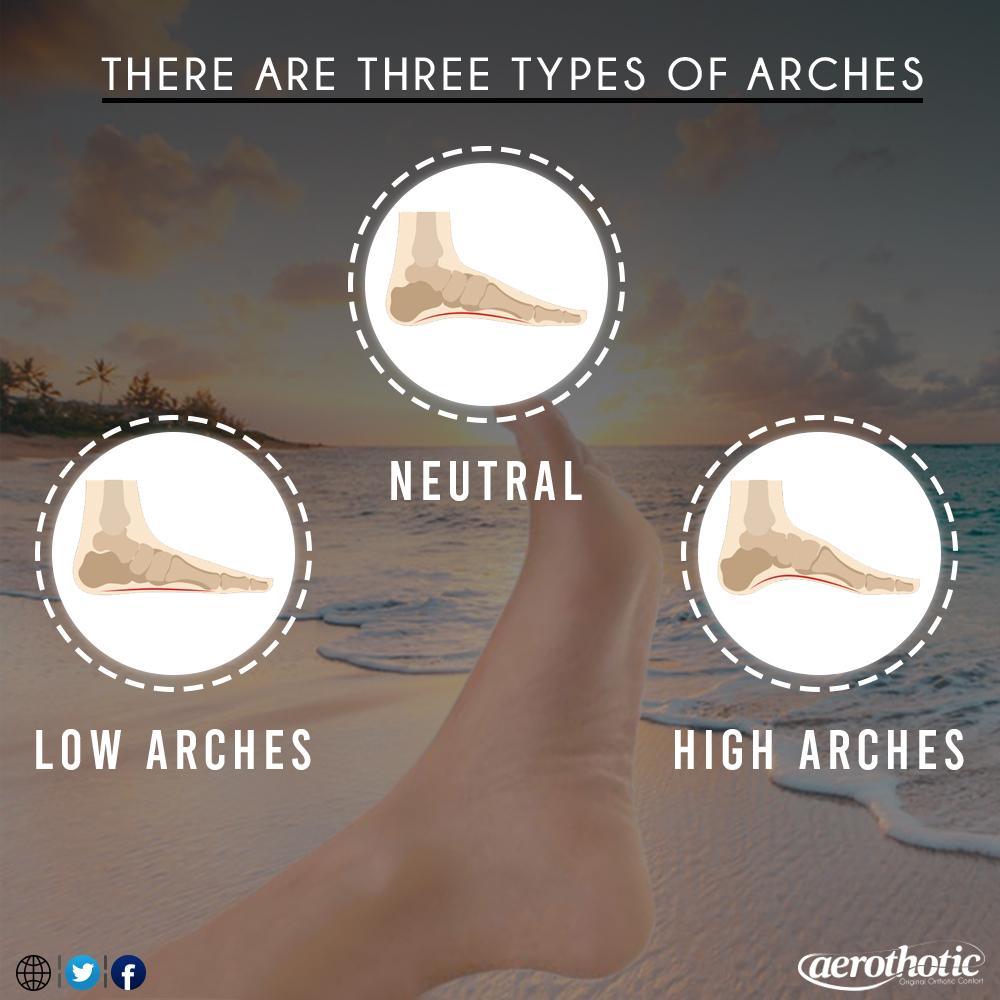 What I Wish Everyone Knew About Foot Arch Type! - Aerothotic: Original Orthotic Comfort Sandals