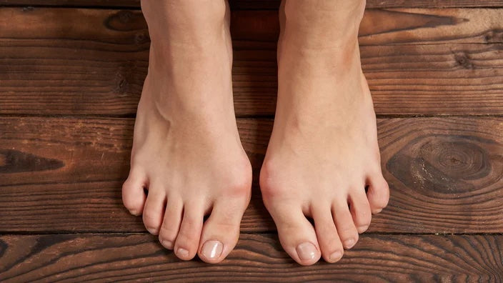 Discover the Comfort and Relief: Aerothotic Orthotic Sandals for Bunions