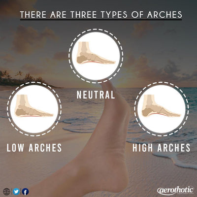 What I Wish Everyone Knew About Foot Arch Type!