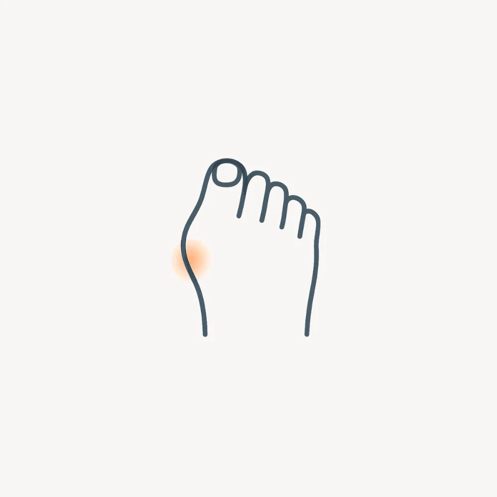 Aerothotic bunion-friendly sandal design, wide toe box and soft materials